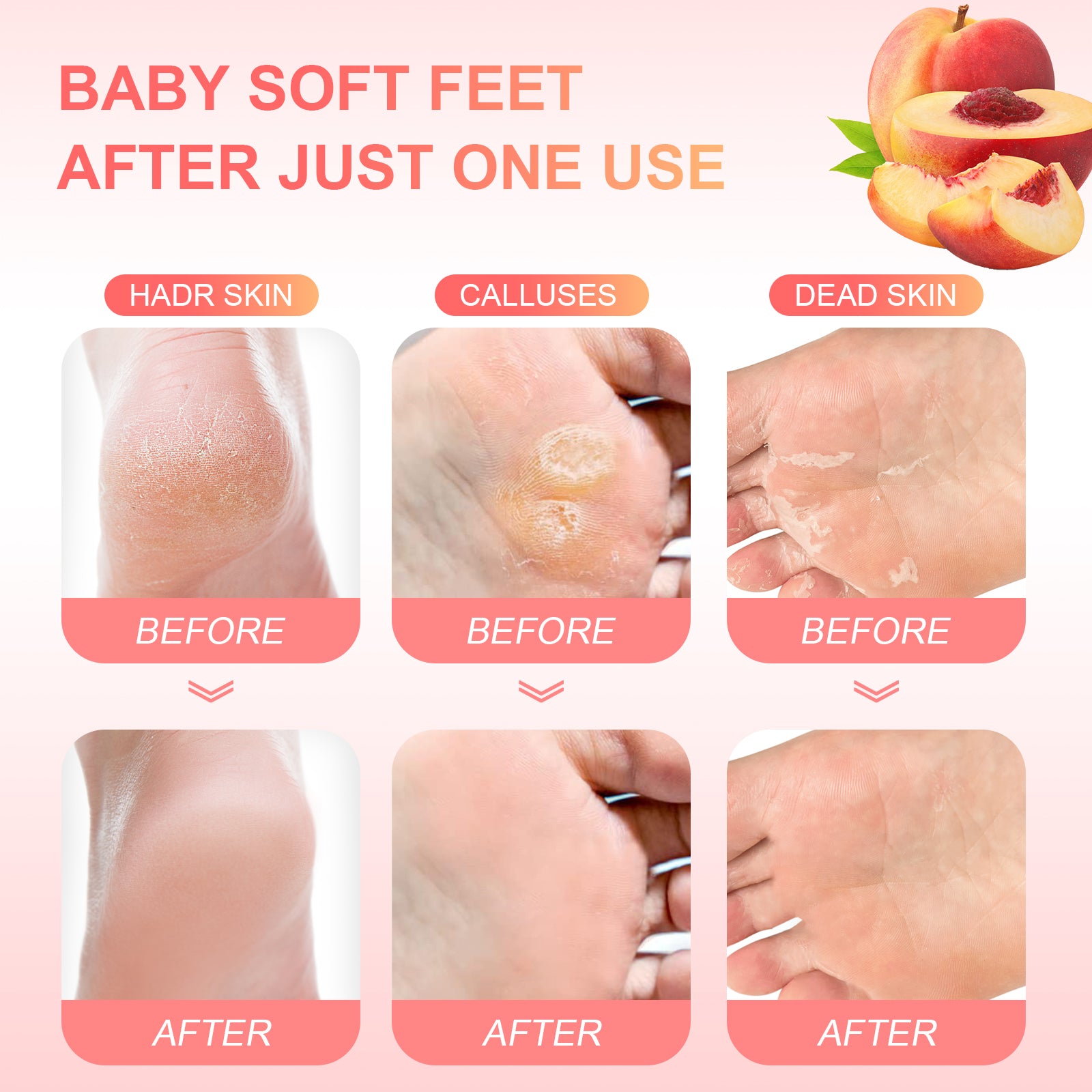 Foot Peeling Mask Exfoliant for Peeling Off Calluses, Natural Exfoliator for Dry Dead Skin, Callus, Repair Rough Heels Soft Smooth Touch